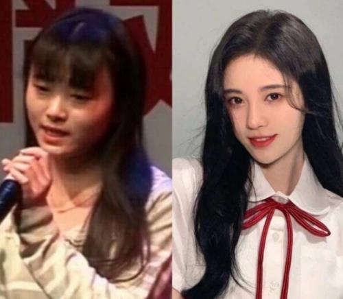 鞠婧祎真的整容了，是真的吗
