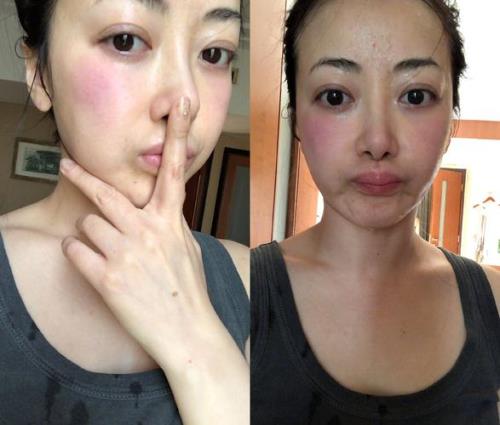 陈紫函是近视眼吗