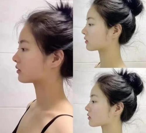 为什么女生喜欢在鼻子上点个籽