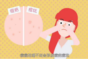痘坑可以自己修复吗，痘坑的修复方法