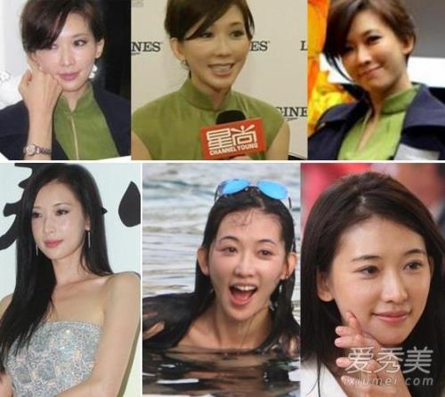 没有整容的女明星