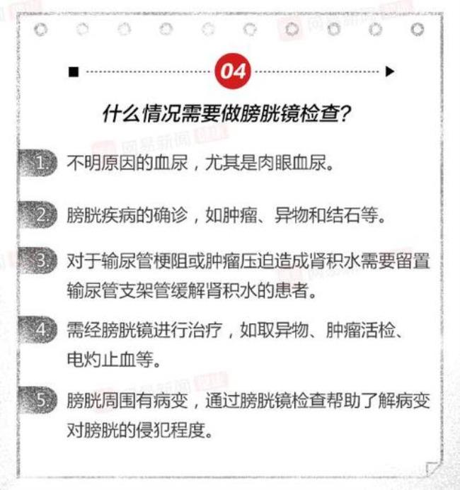 膀胱镜的害处有哪些