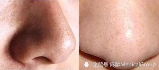 qq换黑头代表什么