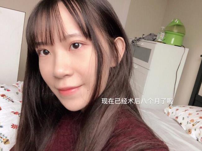割了双眼皮会影响出国过关么