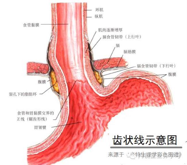 barrett食管怎么办