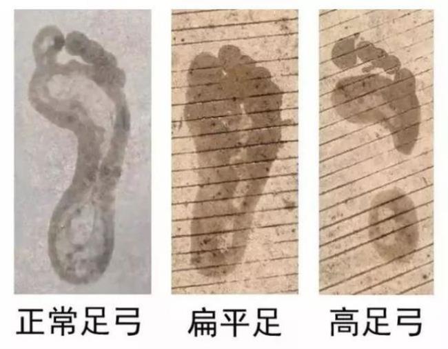 赤兔适合平足吗
