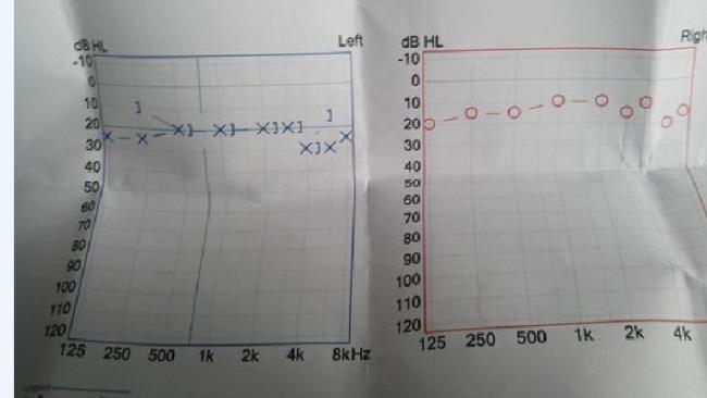 呼噜声一般都是多少分贝