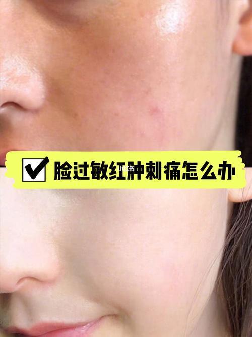 敏感肌一天洗几次脸最合适