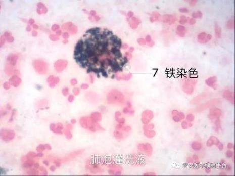 胞液和胞浆的区别是什么