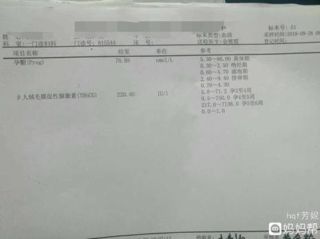 hch是什么银