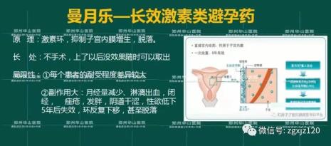 上曼月乐环会老得快吗