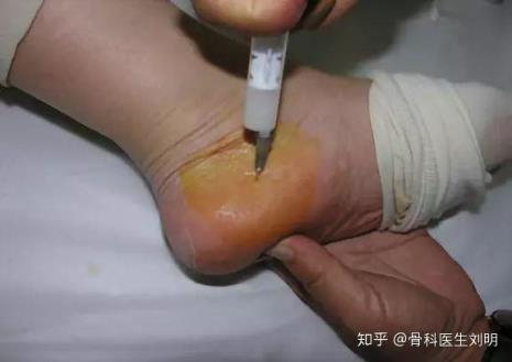 为什么要封维基文库