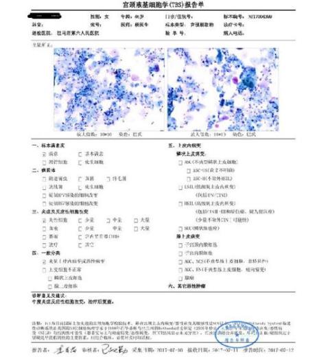 tis报告和tct报告是一样的嘛