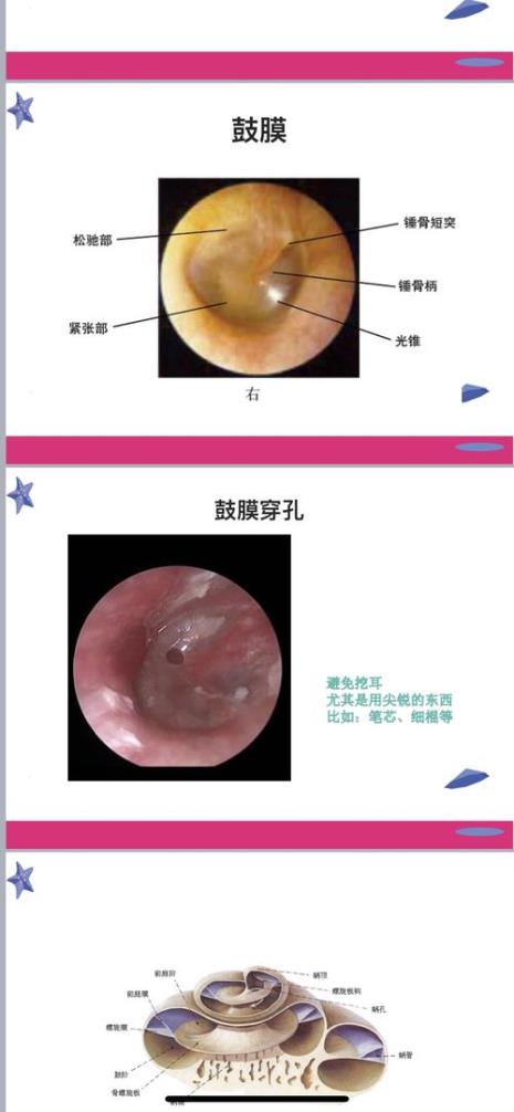 听觉感受器是什么