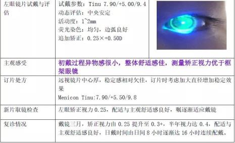 rgp的优点和缺点