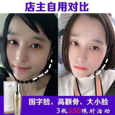 什么软件可以测脸型下颌骨