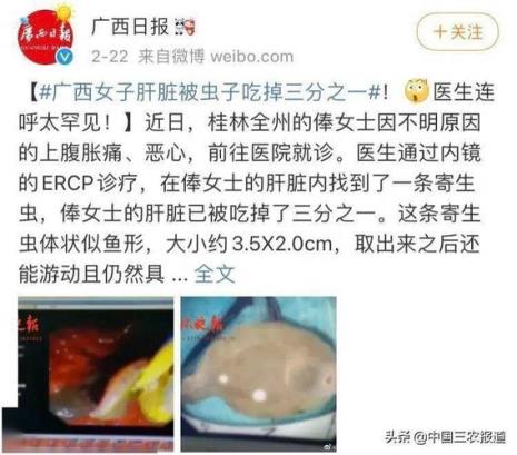 肝吸虫在海里还是淡水里