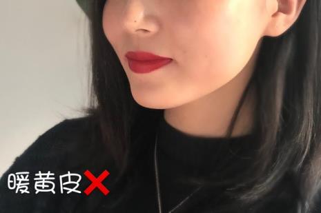暖白皮什么意思