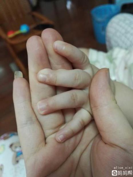 手指上长倒刺是怎么回事