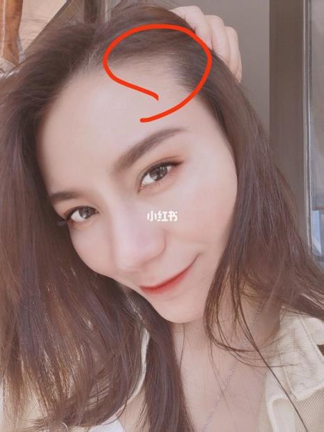 什么软件可以测发际线