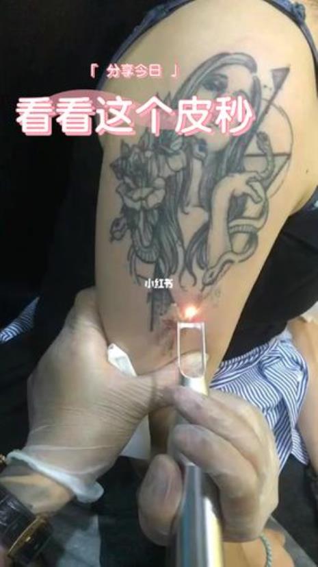 教师体检有纹身怎么办