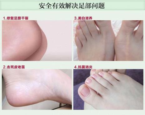 足部美容的日常护理是怎样的