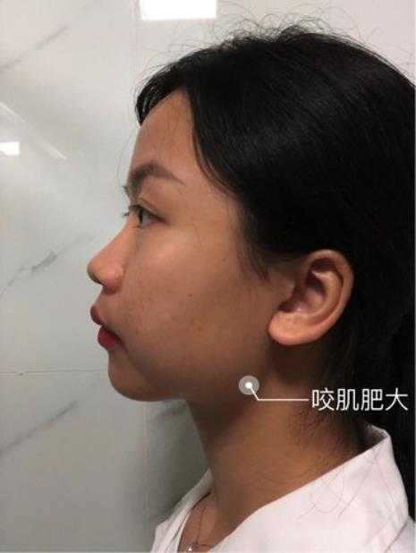 如何判断脸部骨架大小