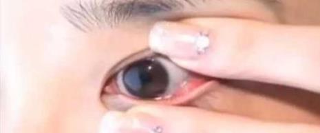 刚到手的隐形眼镜怎么弄