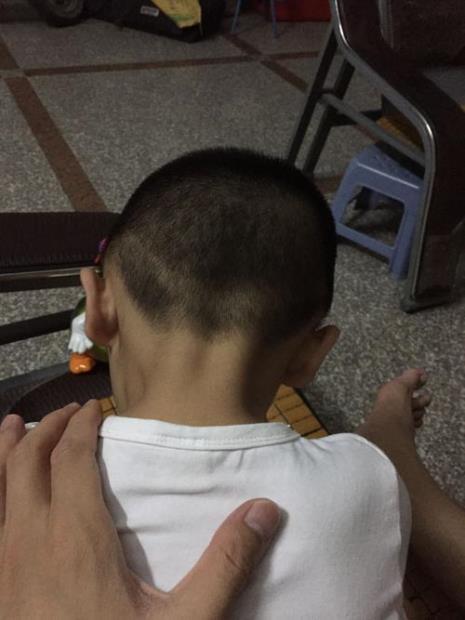 男孩后脑勺突出剪什么头发