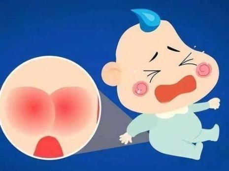小儿红屁屁怎么治疗