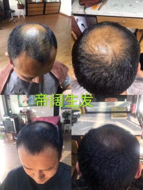 头部管理是什么意思