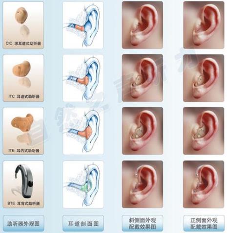 助听器六大品牌有哪些