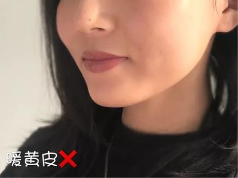 中性皮和冷白皮的区别