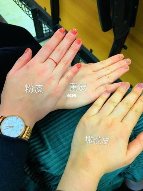 暖黄皮和冷黄皮的区别