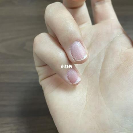 做完美甲指甲变脆怎么办