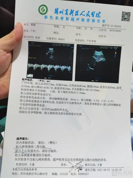 怀孕29周孕妇重多少斤