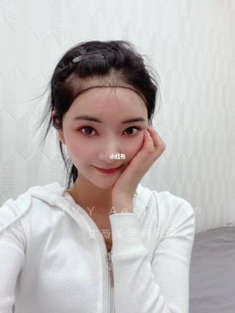 发际线和胎毛的区别