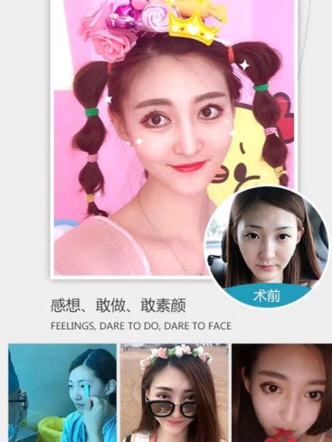 吻眼睛代表什么