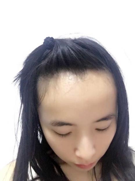 高脑门啥意思