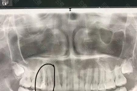 牙盘的牙片怎么换