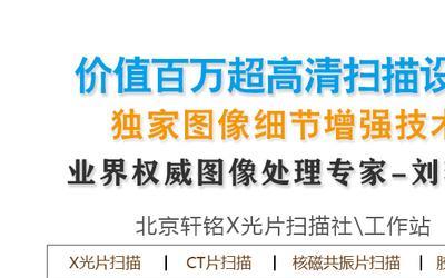 ct电子胶片和传统胶片哪个更清楚