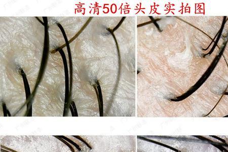 理发店测头皮靠谱吗