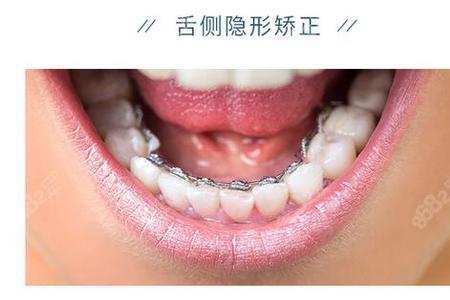 长春什么地方整牙好价格还便宜