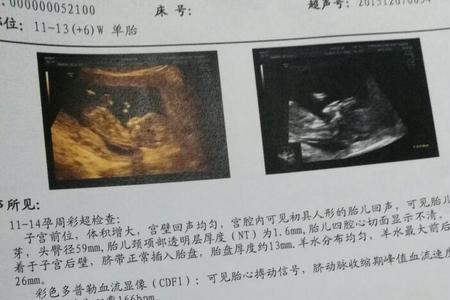不建档可以做mt吗