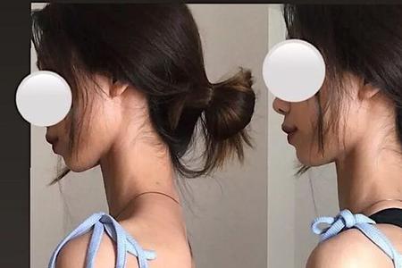 怎么样的肩膀才是直的