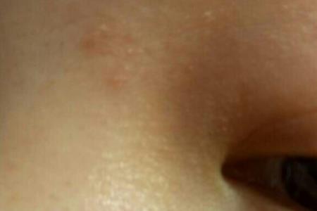 科技布返工有针眼怎样处理