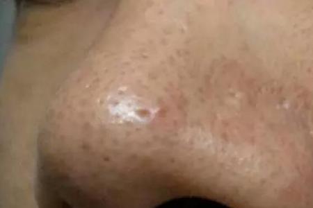 一周不洗脸角质层会有多厚