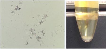 钙的沉淀有哪些