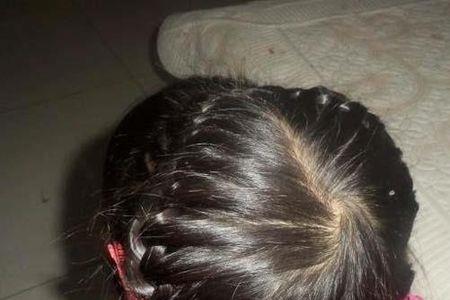 女宝宝头型偏了剪什么发型好