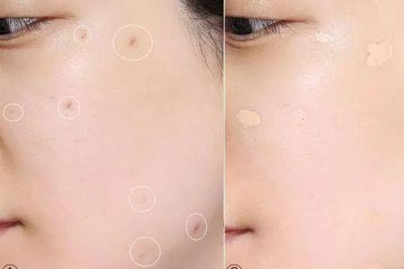 什么时候适合脸部刷酸